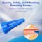 Manual Ear Irrigation Kit for Safe Wax Removal