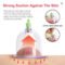 OIMG Electric Cupping Therapy Set Machine with 12 Vacuum Cups